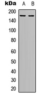TEK / TIE2 Antibody - Western blot analysis of TIE2 expression in HUVEC (A); HepG2 (B) whole cell lysates.