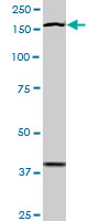 TEK / TIE2 Antibody - TEK monoclonal antibody (M20), clone 3A5. Western blot of TEK expression in NIH/3T3.