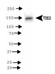 TEK / TIE2 Antibody - TIE2 Antibody - WB detection of TIE2 in Huvec cell lysate.  This image was taken for the unconjugated form of this product. Other forms have not been tested.