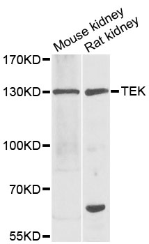 TEK / TIE2 Antibody - Western blot analysis of extracts of various cell lines, using TEK antibody at 1:1000 dilution. The secondary antibody used was an HRP Goat Anti-Rabbit IgG (H+L) at 1:10000 dilution. Lysates were loaded 25ug per lane and 3% nonfat dry milk in TBST was used for blocking. An ECL Kit was used for detection and the exposure time was 90s.