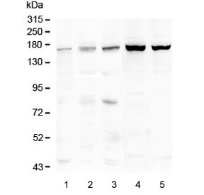 TEK / TIE2 Antibody - Western blot testing of 1) placenta, 2) Caco-2, 3) human HeLa, 4) rat liver and 5) mouse liver lysate with TEK antibody at 0.5ug/ml. Predicted molecular weight: ~126 kDa but may be observable at 130-165 kDa.