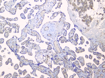 TEK / TIE2 Antibody - IHC staining of FFPE human placenta with TEK antibody at 1ug/ml. HIER: boil tissue sections in pH6, 10mM citrate buffer, for 10-20 min and allow to cool before testing.