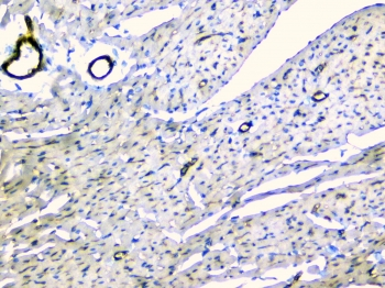 TEK / TIE2 Antibody - IHC staining of FFPE rat heart with TEK antibody at 1ug/ml. HIER: boil tissue sections in pH6, 10mM citrate buffer, for 10-20 min and allow to cool before testing.
