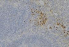 TEK / TIE2 Antibody - 1:100 staining human lymph node tissue by IHC-P. The sample was formaldehyde fixed and a heat mediated antigen retrieval step in citrate buffer was performed. The sample was then blocked and incubated with the antibody for 1.5 hours at 22°C. An HRP conjugated goat anti-rabbit antibody was used as the secondary.