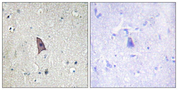 TEK / TIE2 Antibody - Immunohistochemistry analysis of paraffin-embedded human brain, using TIE2 (Phospho-Tyr1102) Antibody. The picture on the right is blocked with the phospho peptide.