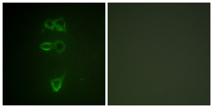 TEK / TIE2 Antibody - Immunofluorescence analysis of HepG2 cells, using TIE2 (Phospho-Tyr1108) Antibody. The picture on the right is blocked with the phospho peptide.