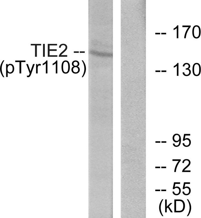 TEK / TIE2 Antibody - Western blot analysis of lysates from NIH/3T3 cells, using TIE2 (Phospho-Tyr1108) Antibody. The lane on the right is blocked with the phospho peptide.