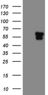 TEKT2 Antibody - HEK293T cells were transfected with the pCMV6-ENTRY control. (Left lane) or pCMV6-ENTRY TEKT2. (Right lane) cDNA for 48 hrs and lysed