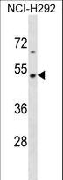 TEKT2 Antibody - TEKT2 Antibody western blot of NCI-H292 cell line lysates (35 ug/lane). The TEKT2 antibody detected the TEKT2 protein (arrow).