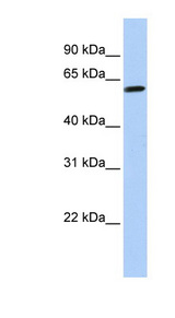TEKT4 Antibody - TEKT4 antibody Western blot of HeLa lysate. This image was taken for the unconjugated form of this product. Other forms have not been tested.