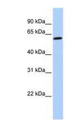 TEKT4 Antibody - TEKT4 antibody Western blot of HeLa lysate. This image was taken for the unconjugated form of this product. Other forms have not been tested.