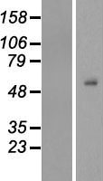 TEKT4 Protein - Western validation with an anti-DDK antibody * L: Control HEK293 lysate R: Over-expression lysate