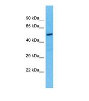 TEKT5 Antibody - Western blot of Human 721_B. TEKT5 antibody dilution 1.0 ug/ml.  This image was taken for the unconjugated form of this product. Other forms have not been tested.