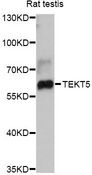 TEKT5 Antibody - Western blot analysis of extracts of rat testis, using TEKT5 antibody at 1:3000 dilution. The secondary antibody used was an HRP Goat Anti-Rabbit IgG (H+L) at 1:10000 dilution. Lysates were loaded 25ug per lane and 3% nonfat dry milk in TBST was used for blocking. An ECL Kit was used for detection and the exposure time was 10s.
