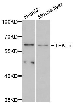 TEKT5 Antibody - Western blot analysis of extracts of various cell lines, using TEKT5 antibody at 1:3000 dilution. The secondary antibody used was an HRP Goat Anti-Rabbit IgG (H+L) at 1:10000 dilution. Lysates were loaded 25ug per lane and 3% nonfat dry milk in TBST was used for blocking. An ECL Kit was used for detection and the exposure time was 90s.