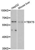 TEKT5 Antibody - Western blot analysis of extracts of various cell lines, using TEKT5 antibody at 1:3000 dilution. The secondary antibody used was an HRP Goat Anti-Rabbit IgG (H+L) at 1:10000 dilution. Lysates were loaded 25ug per lane and 3% nonfat dry milk in TBST was used for blocking. An ECL Kit was used for detection and the exposure time was 90s.