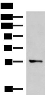 TEKT5 Antibody - Western blot analysis of A172 cell lysate  using TEKT5 Polyclonal Antibody at dilution of 1:800