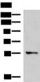 TEKT5 Antibody - Western blot analysis of A172 cell lysate  using TEKT5 Polyclonal Antibody at dilution of 1:800