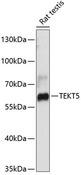 TEKT5 Antibody - Western blot analysis of extracts of rat testis using TEKT5 Polyclonal Antibody at dilution of 1:3000.