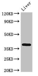 TEL-2 / ETV7 Antibody - Western Blot Positive WB detected in:Rat liver tissue All Lanes:ETV7 antibody at 3µg/ml Secondary Goat polyclonal to rabbit IgG at 1/50000 dilution Predicted band size: 39,33,31,37,30,23 KDa Observed band size: 39 KDa