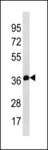 TEL-2 / ETV7 Antibody - ETV7 Antibody western blot of NCI-H292 cell line lysates (35 ug/lane). The ETV7 antibody detected the ETV7 protein (arrow).