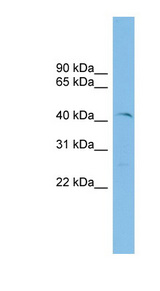 TEL-2 / ETV7 Antibody - ETV7 antibody Western blot of ACHN lysate. This image was taken for the unconjugated form of this product. Other forms have not been tested.