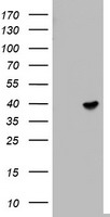 TEL-2 / ETV7 Antibody - HEK293T cells were transfected with the pCMV6-ENTRY control (Left lane) or pCMV6-ENTRY ETV7 (Right lane) cDNA for 48 hrs and lysed. Equivalent amounts of cell lysates (5 ug per lane) were separated by SDS-PAGE and immunoblotted with anti-ETV7.