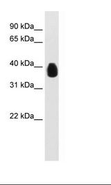 TEL-2 / ETV7 Antibody - Transfected 293T Cell Lysate.  This image was taken for the unconjugated form of this product. Other forms have not been tested.