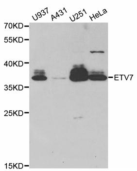 TEL-2 / ETV7 Antibody - Western blot analysis of extracts of various cell lines.