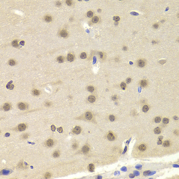 TEL-2 / ETV7 Antibody - Immunohistochemistry of paraffin-embedded Mouse brain tissue.