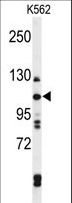 TELO2 Antibody - Western blot of TELO2 Antibody in K562 cell line lysates (35 ug/lane). TELO2 (arrow) was detected using the purified antibody.