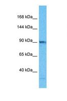 TELO2 Antibody - Western blot of Human HepG2. TELO2 antibody dilution 1.0 ug/ml.  This image was taken for the unconjugated form of this product. Other forms have not been tested.