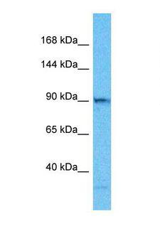 TELO2 Antibody - Western blot of Human HepG2. TELO2 antibody dilution 1.0 ug/ml.  This image was taken for the unconjugated form of this product. Other forms have not been tested.