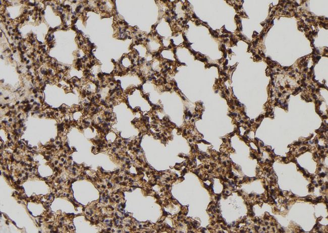 TELO2 Antibody - 1:100 staining mouse lung tissue by IHC-P. The sample was formaldehyde fixed and a heat mediated antigen retrieval step in citrate buffer was performed. The sample was then blocked and incubated with the antibody for 1.5 hours at 22°C. An HRP conjugated goat anti-rabbit antibody was used as the secondary.