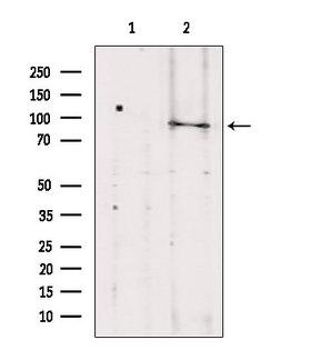 TELO2 Antibody - Western blot analysis of extracts of HeLa cells using TELO2 antibody. Lane 1 was treated with the blocking peptide.