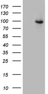 TEM1 / CD248 Antibody - HEK293T cells were transfected with the pCMV6-ENTRY control. (Left lane) or pCMV6-ENTRY CD248. (Right lane) cDNA for 48 hrs and lysed. Equivalent amounts of cell lysates. (5 ug per lane) were separated by SDS-PAGE and immunoblotted with anti-CD248. (1:500)