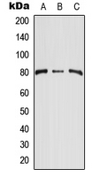 TEM1 / CD248 Antibody - Western blot analysis of CD248 expression in HEK293T (A); NIH3T3 (B); H9C2 (C) whole cell lysates.
