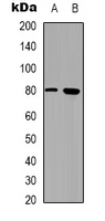 TEM1 / CD248 Antibody - Western blot analysis of CD248 expression in HEK293T (A); HepG2 (B) whole cell lysates.
