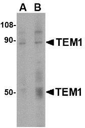 TEM1 / CD248 Antibody - Western blot of TEM1 in human colon tissue lysate with TEM1 antibody at (A) 0.5 and (B) 1 ug/ml. Below: Immunohistochemistry of TEM1 in human colon tissue with TEM1 antibody at 2.5 ug/ml.