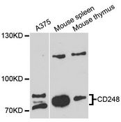 TEM1 / CD248 Antibody - Western blot analysis of extracts of various cell lines, using CD248 antibody at 1:3000 dilution. The secondary antibody used was an HRP Goat Anti-Rabbit IgG (H+L) at 1:10000 dilution. Lysates were loaded 25ug per lane and 3% nonfat dry milk in TBST was used for blocking. An ECL Kit was used for detection and the exposure time was 90s.