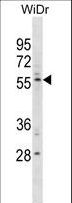 TEM7 Antibody - PLXDC1 Antibody western blot of WiDr cell line lysates (35 ug/lane). The PLXDC1 antibody detected the PLXDC1 protein (arrow).