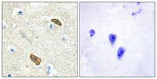 TEM7 Antibody - Immunohistochemistry analysis of paraffin-embedded human brain, using PLXDC1 Antibody. The picture on the right is blocked with the synthesized peptide.