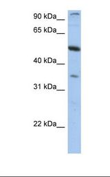 TEM7 Antibody - HepG2 cell lysate. Antibody concentration: 1.0 ug/ml. Gel concentration: 12%.  This image was taken for the unconjugated form of this product. Other forms have not been tested.