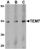 TEM7 Antibody - Western blot of TEM7 in human liver tissue lysate with TEM7 antibody at (A) 0.5, (B) 1 and (C) 2 ug/ml.