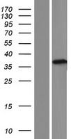 TEPP Protein - Western validation with an anti-DDK antibody * L: Control HEK293 lysate R: Over-expression lysate