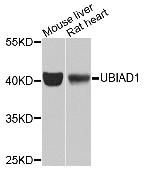 TERE1 / UBIAD1 Antibody - Western blot analysis of extracts of various tissues.