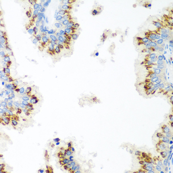 TERE1 / UBIAD1 Antibody - Immunohistochemistry of paraffin-embedded human prostate.
