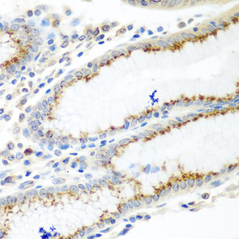 TERE1 / UBIAD1 Antibody - Immunohistochemistry of paraffin-embedded human stomach tissue.