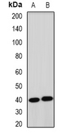 TERE1 / UBIAD1 Antibody - Western blot analysis of TERE1 expression in mouse liver (A); rat heart (B) whole cell lysates.