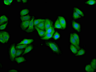 TERE1 / UBIAD1 Antibody - Immunofluorescence staining of HepG2 cells at a dilution of 1:66, counter-stained with DAPI. The cells were fixed in 4% formaldehyde, permeabilized using 0.2% Triton X-100 and blocked in 10% normal Goat Serum. The cells were then incubated with the antibody overnight at 4 °C.The secondary antibody was Alexa Fluor 488-congugated AffiniPure Goat Anti-Rabbit IgG (H+L) .